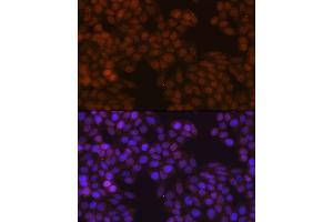 Immunofluorescence analysis of HeLa cells using FSP1/S100 Rabbit mAb (ABIN7270125) at dilution of 1:100 (40x lens). (s100a4 Antikörper)