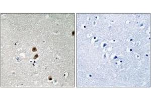 Immunohistochemistry analysis of paraffin-embedded human brain, using CtBP1 (Phospho-Ser422) Antibody. (CTBP1 Antikörper  (pSer422))