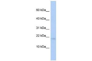 RFESD antibody used at 1 ug/ml to detect target protein. (RFESD Antikörper)