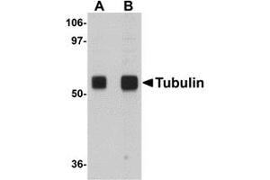 Western Blotting (WB) image for anti-alpha Tubulin (TUBA1) (N-Term) antibody (ABIN1031226) (alpha Tubulin Antikörper  (N-Term))