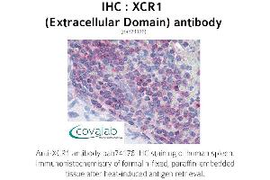 Image no. 1 for anti-Chemokine (C Motif) Receptor 1 (XCR1) (3rd Extracellular Domain) antibody (ABIN1740868) (XCR1 Antikörper  (3rd Extracellular Domain))