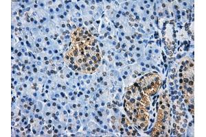 Immunohistochemical staining of paraffin-embedded Kidney tissue using anti-HDAC10mouse monoclonal antibody. (HDAC10 Antikörper)