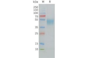 Cynomolgus CD24 Protein, hFc Tag on SDS-PAGE under reducing condition. (CD24 Protein (AA 27-54) (Fc Tag))