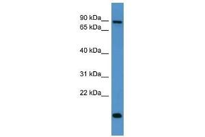 App antibody used at 0. (APP Antikörper  (C-Term))