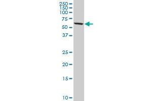 Western Blotting (WB) image for anti-DEAD (Asp-Glu-Ala-Asp) Box Polypeptide 56 (DDX56) (AA 450-547) antibody (ABIN527138)