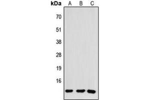 Western blot analysis of CCL26 expression in HEK293T (A), NS-1 (B), H9C2 (C) whole cell lysates. (CCL26 Antikörper  (Center))