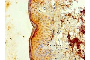 Immunohistochemistry of paraffin-embedded human skin tissue using ABIN7156730 at dilution of 1:100 (IL1A Antikörper  (AA 1-152))