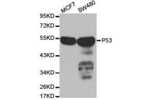 Western Blotting (WB) image for anti-Tumor Protein P53 (TP53) antibody (ABIN1875167) (p53 Antikörper)