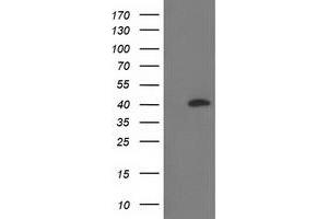 HEK293T cells were transfected with the pCMV6-ENTRY control (Left lane) or pCMV6-ENTRY RLBP1 (Right lane) cDNA for 48 hrs and lysed. (RLBP1 Antikörper)