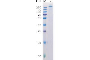 Human C Protein, His Tag on SDS-PAGE under reducing condition. (NG2 Protein (AA 30-2224) (His tag))