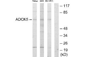 Western blot analysis of extracts from HeLa cells, 293 cells and HUVEC cells, using ADCK5 antibody. (ADCK5 Antikörper  (Internal Region))