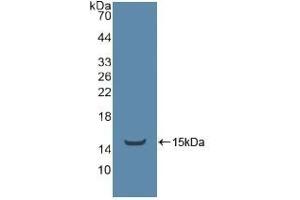 Detection of Recombinant ADRbK1, Human using Polyclonal Antibody to TEK Tyrosine Kinase, Endothelial (Tie2) (TEK Antikörper  (AA 1-116))