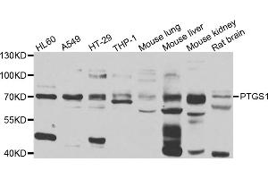 Western blot analysis of extracts of various cell lines, using PTGS1 antibody (ABIN4904895) at 1:1000 dilution. (PTGS1 Antikörper)