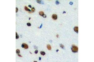 Immunohistochemical analysis of CstF-64T staining in human brain formalin fixed paraffin embedded tissue section. (CstF-64T Antikörper)