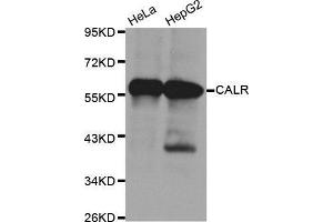 Western Blotting (WB) image for anti-Calreticulin (CALR) antibody (ABIN6214923) (Calreticulin Antikörper)