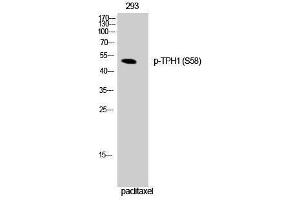 Western Blotting (WB) image for anti-Tryptophan Hydroxylase 1 (TPH1) (pSer58) antibody (ABIN3173282) (Tryptophan Hydroxylase 1 Antikörper  (pSer58))
