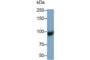 Detection of C4B in Mouse Placenta lysate using Polyclonal Antibody to Complement C4-B (C4B) (C4B Antikörper  (AA 126-366))