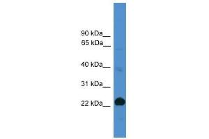 CD8A antibody used at 0. (CD8 alpha Antikörper  (Middle Region))