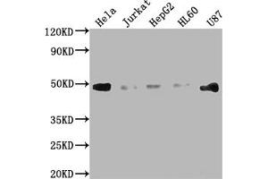 Western Blot Positive WB detected in: Hela whole cell lysate, Jurkat whole cell lysate, HepG2 whole cell lysate, HL60 whole cell lysate, U87 whole cell lysate All lanes: FAS antibody at 1:2000 Secondary Goat polyclonal to rabbit IgG at 1/50000 dilution Predicted band size: 38, 12, 10, 17, 15, 36, 25 kDa Observed band size: 45 kDa (Rekombinanter FAS Antikörper)