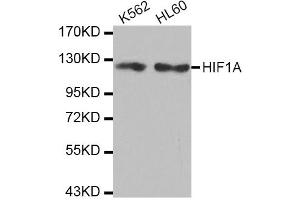 Western blot analysis of extracts of various cell lines, using HIF1A antibody (ABIN2968869). (HIF1A Antikörper)
