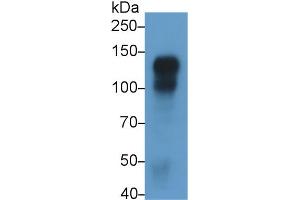 Detection of CDH5 in Rat Placenta lysate using Monoclonal Antibody to Cadherin 5 (CDH5) (Cadherin 5 Antikörper  (AA 59-382))