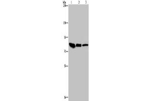 Western Blotting (WB) image for anti-Junction Plakoglobin (JUP) antibody (ABIN2423687) (JUP Antikörper)