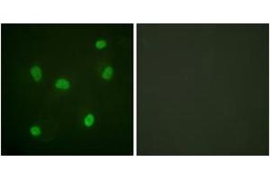 Immunofluorescence analysis of HeLa cells, using Histone H2B (Ab-5) Antibody. (Histone H2B Antikörper  (AA 1-50))