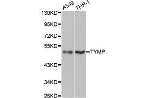 Western blot analysis of extracts of various cell lines, using TYMP antibody (ABIN5970450) at 1/1000 dilution. (Thymidine Phosphorylase Antikörper)