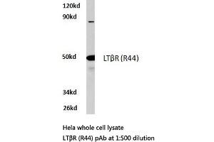 Western blot (WB) analysis of LTβR antibody in extracts from HeLa cells. (LTBR Antikörper)
