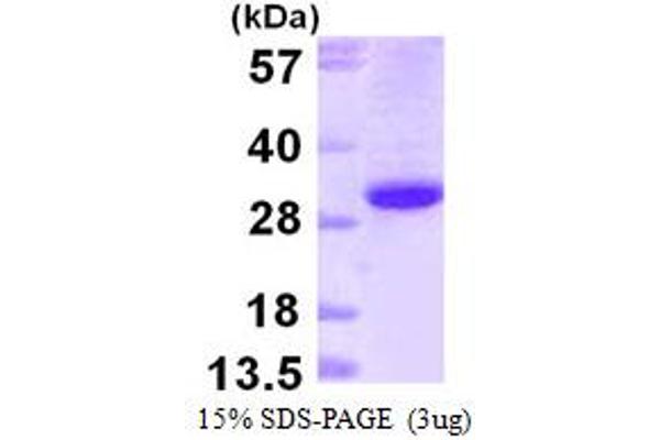 Ephrin B1 Protein (EFNB1) (AA 28-237) (His tag)