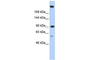 SPTAN1 antibody used at 1 ug/ml to detect target protein. (SPTAN1 Antikörper)