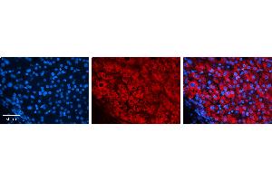 Rabbit Anti-EIF4G2 Antibody   Formalin Fixed Paraffin Embedded Tissue: Human Liver Tissue Observed Staining: Cytoplasm in hepatocytes Primary Antibody Concentration: 1:100 Other Working Concentrations: N/A Secondary Antibody: Donkey anti-Rabbit-Cy3 Secondary Antibody Concentration: 1:200 Magnification: 20X Exposure Time: 0. (EIF4G2 Antikörper  (N-Term))