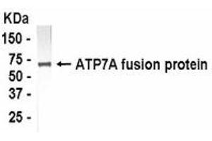 Western Blotting (WB) image for anti-ATPase, Cu++ Transporting, alpha Polypeptide (ATP7A) (AA 1407-1500) antibody (ABIN2467776) (ATP7A Antikörper  (AA 1407-1500))