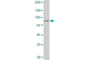 VIL1 MaxPab rabbit polyclonal antibody. (Villin 1 Antikörper  (AA 1-421))