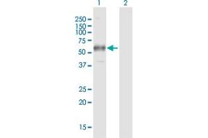 Western Blot analysis of FCGR1A expression in transfected 293T cell line by FCGR1A MaxPab polyclonal antibody. (FCGR1A Antikörper  (AA 1-374))