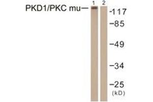 Western Blotting (WB) image for anti-Protein Kinase D1 (PRKD1) (AA 429-478) antibody (ABIN2888772) (PKC mu Antikörper  (AA 429-478))