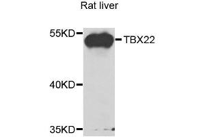 Western blot analysis of extracts of rat liver, using TBX22 antibody. (T-Box 22 Antikörper  (AA 291-520))