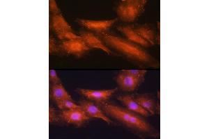 Immunofluorescence analysis of H9C2 cells using [KO Validated] HINT1 Rabbit pAb  at dilution of 1:100 (40x lens). (HINT1 Antikörper  (AA 1-126))