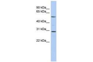 Image no. 1 for anti-V-Rel Reticuloendotheliosis Viral Oncogene Homolog B (RELB) (AA 395-444) antibody (ABIN6744395) (RELB Antikörper  (AA 395-444))