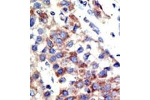 Image no. 2 for anti-Histone 3 (H3) (H3K9me2) antibody (ABIN356586) (Histone 3 Antikörper  (H3K9me2))