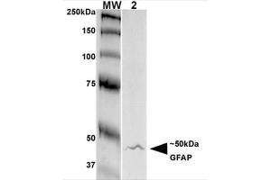 Western Blot analysis of Rat Brain Membrane showing detection of GFAP protein using Mouse Anti-GFAP Monoclonal Antibody, Clone S206A-8 . (GFAP Antikörper  (AA 411-422) (PE))