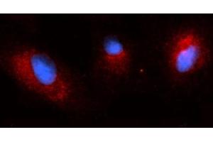 Immunofluorescence (IF) image for anti-Osteoactivin (GPNMB) (AA 22-474) antibody (PE) (ABIN5566465) (Osteoactivin Antikörper  (AA 22-474) (PE))
