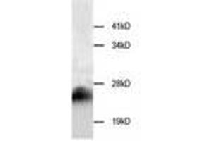 Image no. 1 for anti-Cystatin B (Stefin B) (CSTB) antibody (ABIN791546) (CSTB Antikörper)