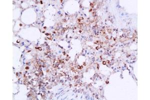 Immunohistochemistry (Paraffin-embedded Sections) (IHC (p)) image for anti-Interleukin 6 (IL6) (AA 111-150) antibody (ABIN728083)