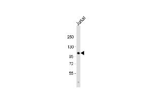 Anti-Parg Antibody (C-term) at 1:1000 dilution + Jurkat whole cell lysate Lysates/proteins at 20 μg per lane. (PARG Antikörper  (C-Term))