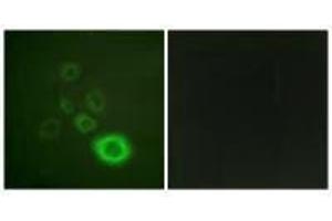 Immunofluorescence analysis of A549 cells, using c-Met (Ab-1003) antibody. (c-MET Antikörper  (Tyr1003))