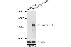 Western blot analysis of extracts of NIH/3T3 cells, using Phospho-HDAC5-S498 antibody (ABIN2987596) at 1/2000 dilution. (HDAC5 Antikörper  (pSer498))