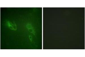 Immunofluorescence analysis of NIH-3T3 cells, using IR (Ab-999) Antibody. (IR (AA 881-930) Antikörper)