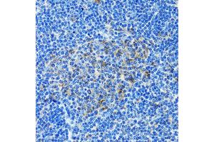 Immunohistochemistry of paraffin-embedded rat spleen using PAICS antibody. (PAICS Antikörper)