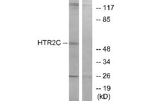 Western blot analysis of extracts from Jurkat cells, using HTR2C antibody. (HTR2C Antikörper  (C-Term))